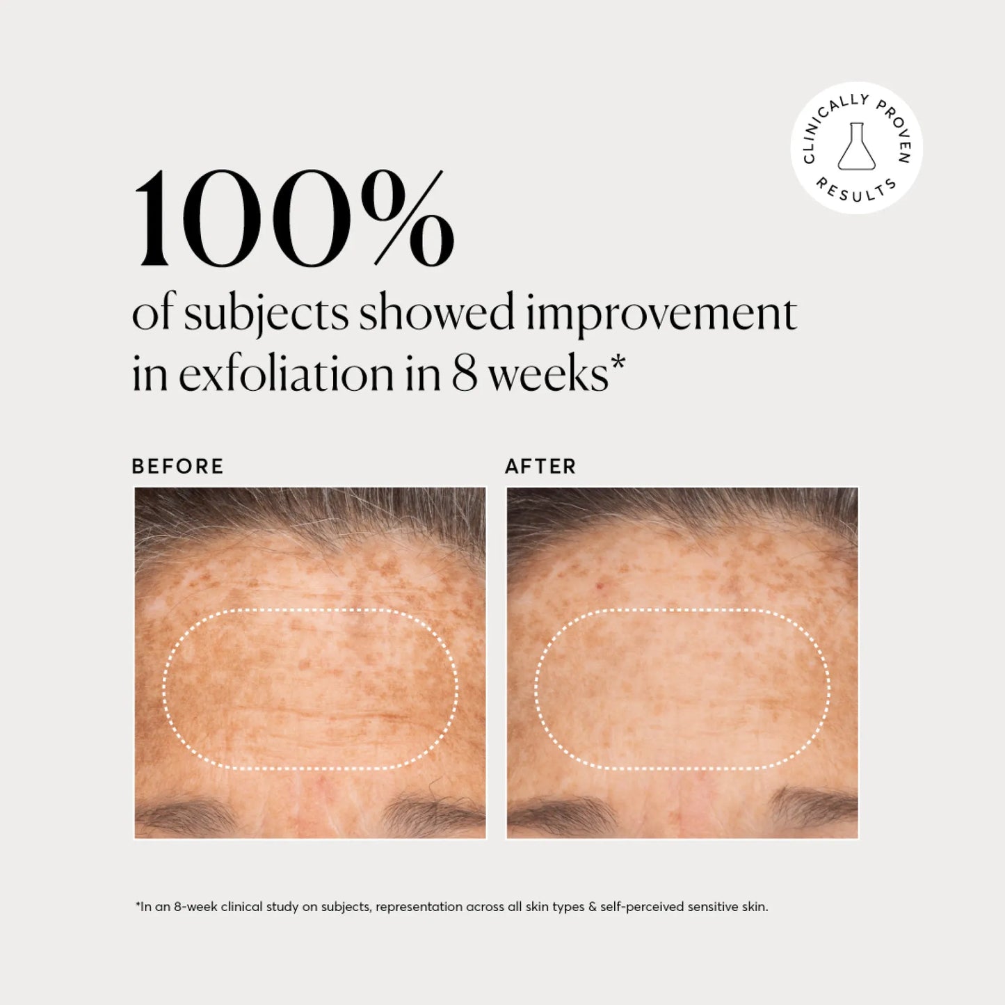 bha-liquid-exfoliant-2-m8 NATR-10027-Alt-Images-BHA-Liquid-Exfoliant-2_-03.webp