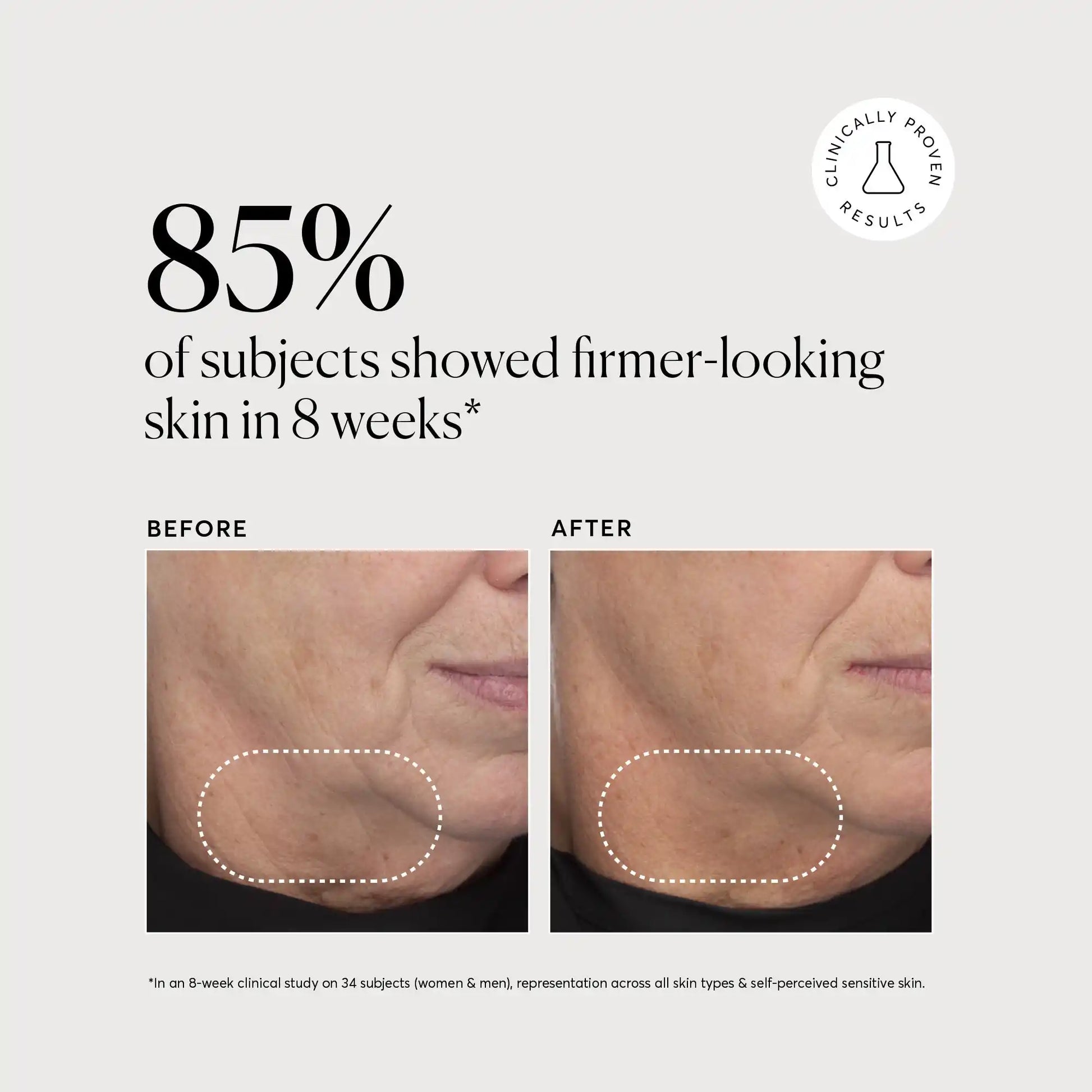 retinol-complex-serum-z3 NATR-10034-Alt-Images-Retinol-Complex-Serum-04.webp